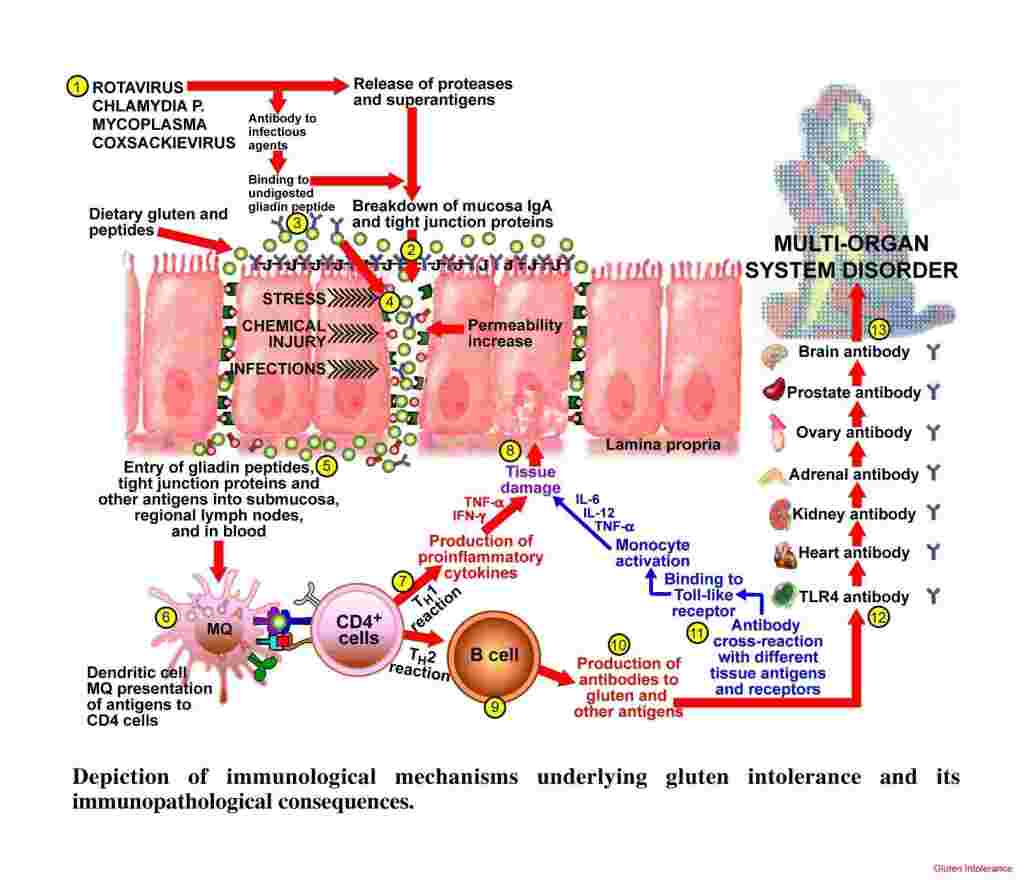 How Gluten Affects Hashimoto's